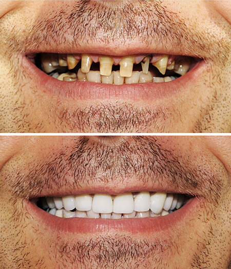 Ogden, Utah dentist smile gallery 02 Ogden, Utah dentist smile gallery 02