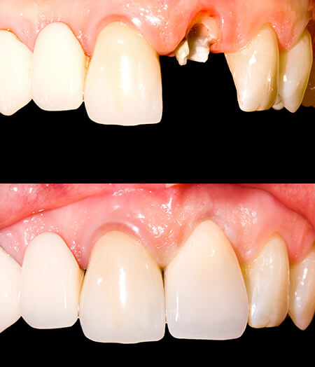Ogden, Utah dentist smile gallery 05 Ogden, Utah dentist smile gallery 05