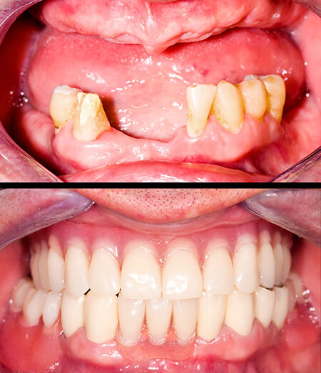 Ogden, Utah dentist smile gallery 08 Ogden, Utah dentist smile gallery 08